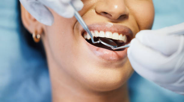 Best Emergency Dentist for Knocked-Out Tooth in Pinconning, MI